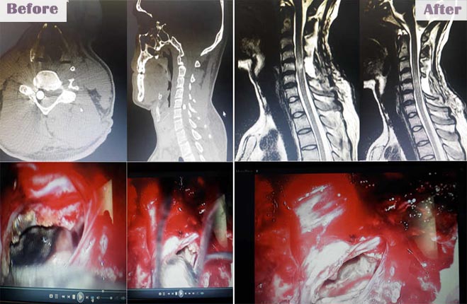 brainandspinecareindia slide3