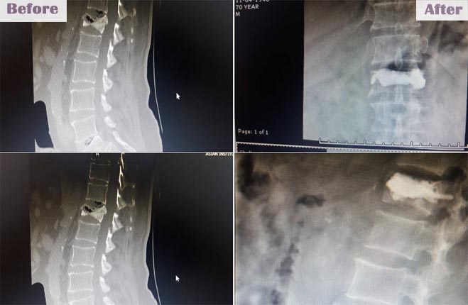 brainandspinecareindia slide8