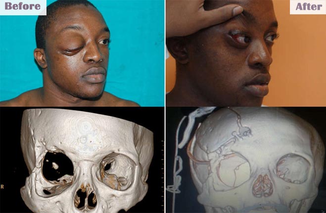 brainandspinecareindia slide9