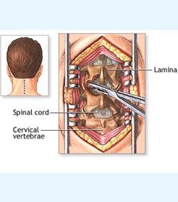 360 Degree Procedure for Cervical and Thoracic Spine